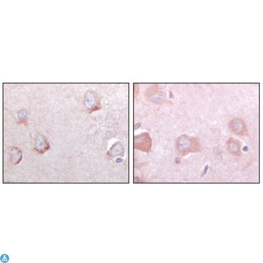 Monoclonal Mouse anti-Human SORL1 Antibody (IHC, IF, WB)