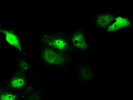 SRR / Serine Racemase Antibody (clone OTI2E3)