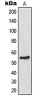 GCK / Glucokinase Antibody (N-Terminus)