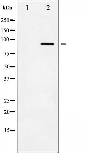 IKBKB / IKK2 / IKK Beta Antibody (phospho-Tyr199)