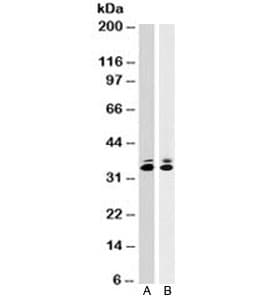 PCNA Antibody (clone SPM350)