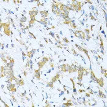 KLHL42 / KLHDC5 Antibody