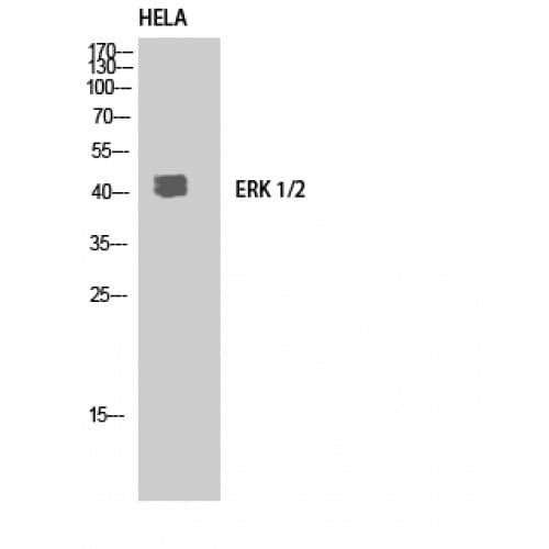Polyclonal Rabbit anti-Human ERK1 + ERK2 Antibody (300-380 aa, C-terminal, IHC, WB)