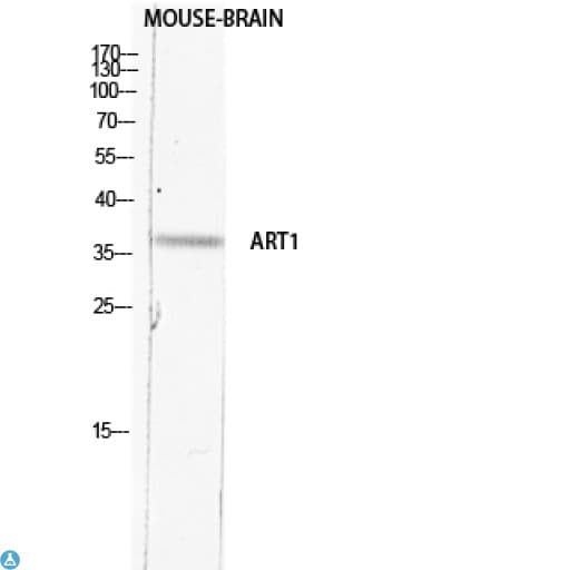 ART1 /CD296 Antibody