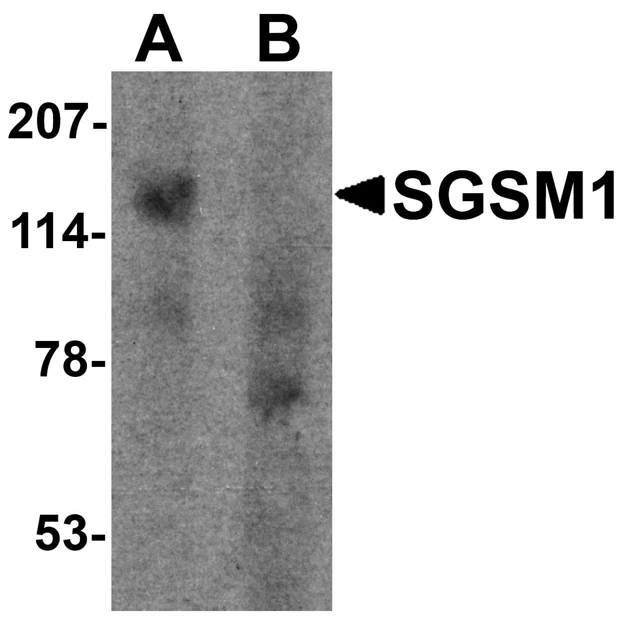 IHC-plus™ SGSM1 Antibody