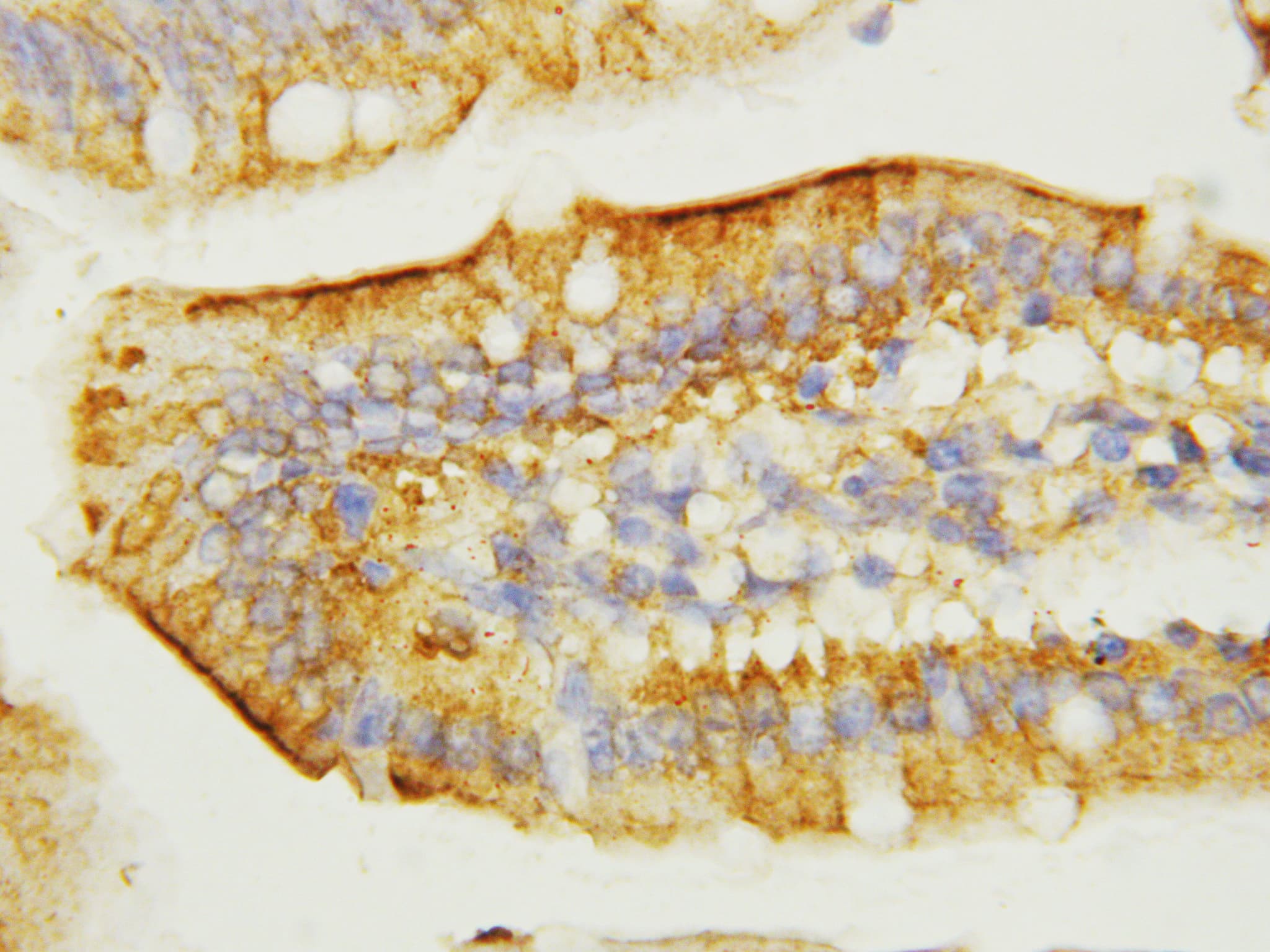 EGF Antibody (aa1013-1029)