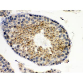 UPF3B Antibody (aa416-452)