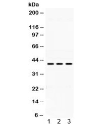 ADH1A / Alcohol Dehydrogenase Antibody