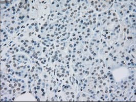 MAP2K2 / MKK2 / MEK2 Antibody (clone OTI5F6)