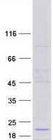 Human UXT Protein (Recombinant Myc-DDK (Flag))