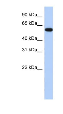 Polyclonal Rabbit anti-Human ZNF554 Antibody (aa35-84, WB)