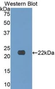 COL17A1 / Collagen XVII Antibody (aa184-375, APC)