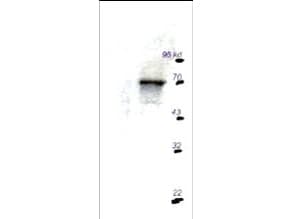 IHC-plus™ RPS6KB1 / P70S6K / S6K Antibody
