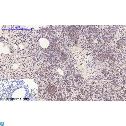 Polyclonal Rabbit anti-Human E2F1 Antibody (WB)