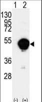 Polyclonal Rabbit anti-Human CYP-M / CYP20A1 Antibody (aa364-392, IHC, WB)