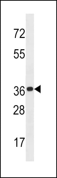 Polyclonal Rabbit anti-Human KCTD20 Antibody (aa313-341, WB)