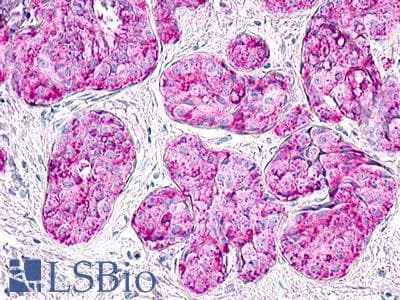 PathPlus™ Polyclonal Rabbit anti-Human MLNR/GPR38/Motilin Receptor Antibody (Cytoplasmic Domain, IHC)