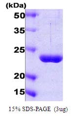 Human PSMD10 / Gankyrin Protein (Recombinant)