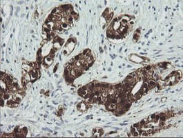 CMPK / CMPK1 Antibody (clone OTI2F5, Carrier-free)