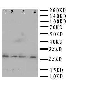 HLA-DMB Antibody (aa81-100)