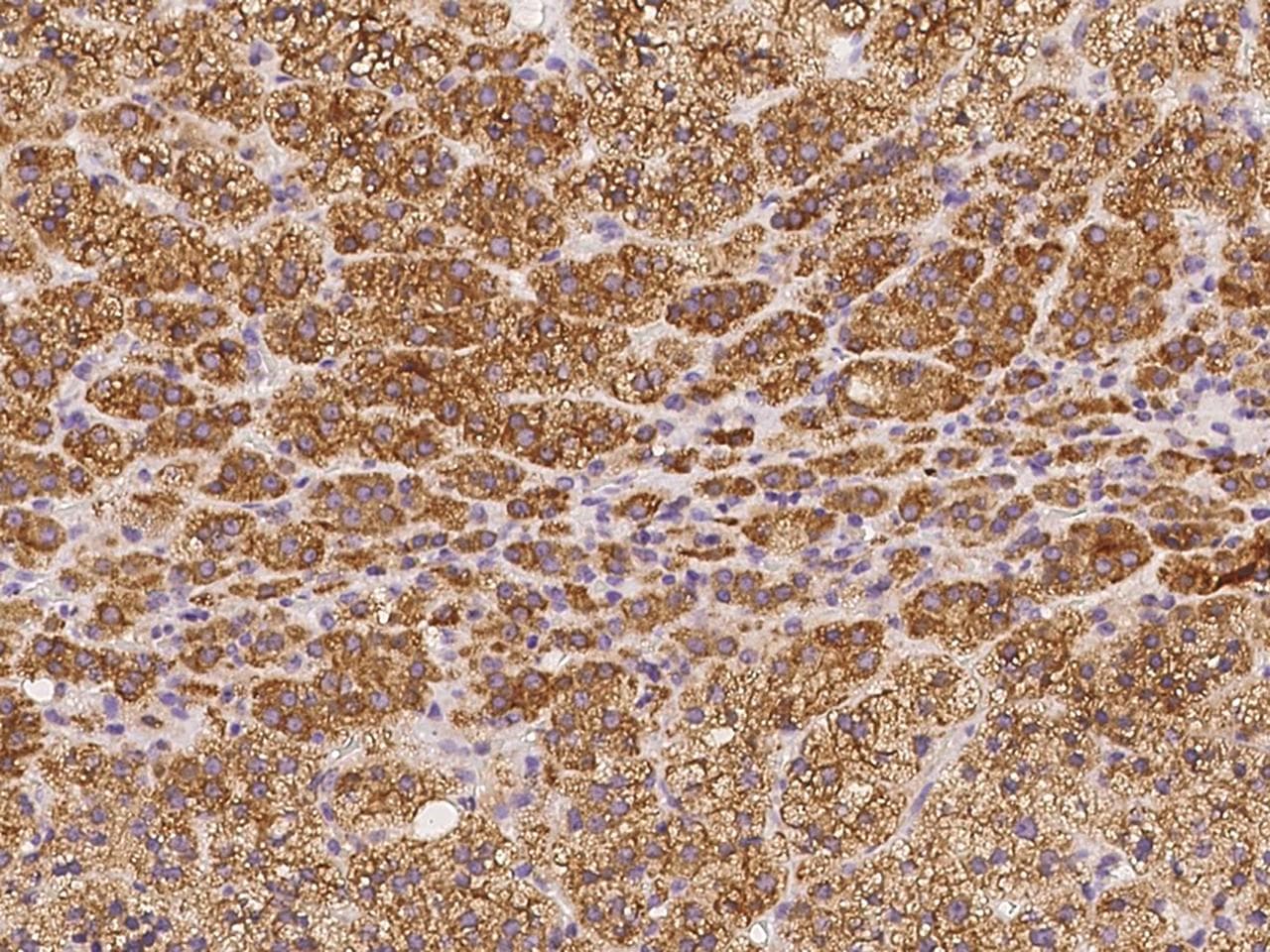 TEX264 Antibody