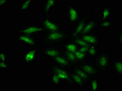 Polyclonal Rabbit anti-Human DDX17 Antibody (IF)