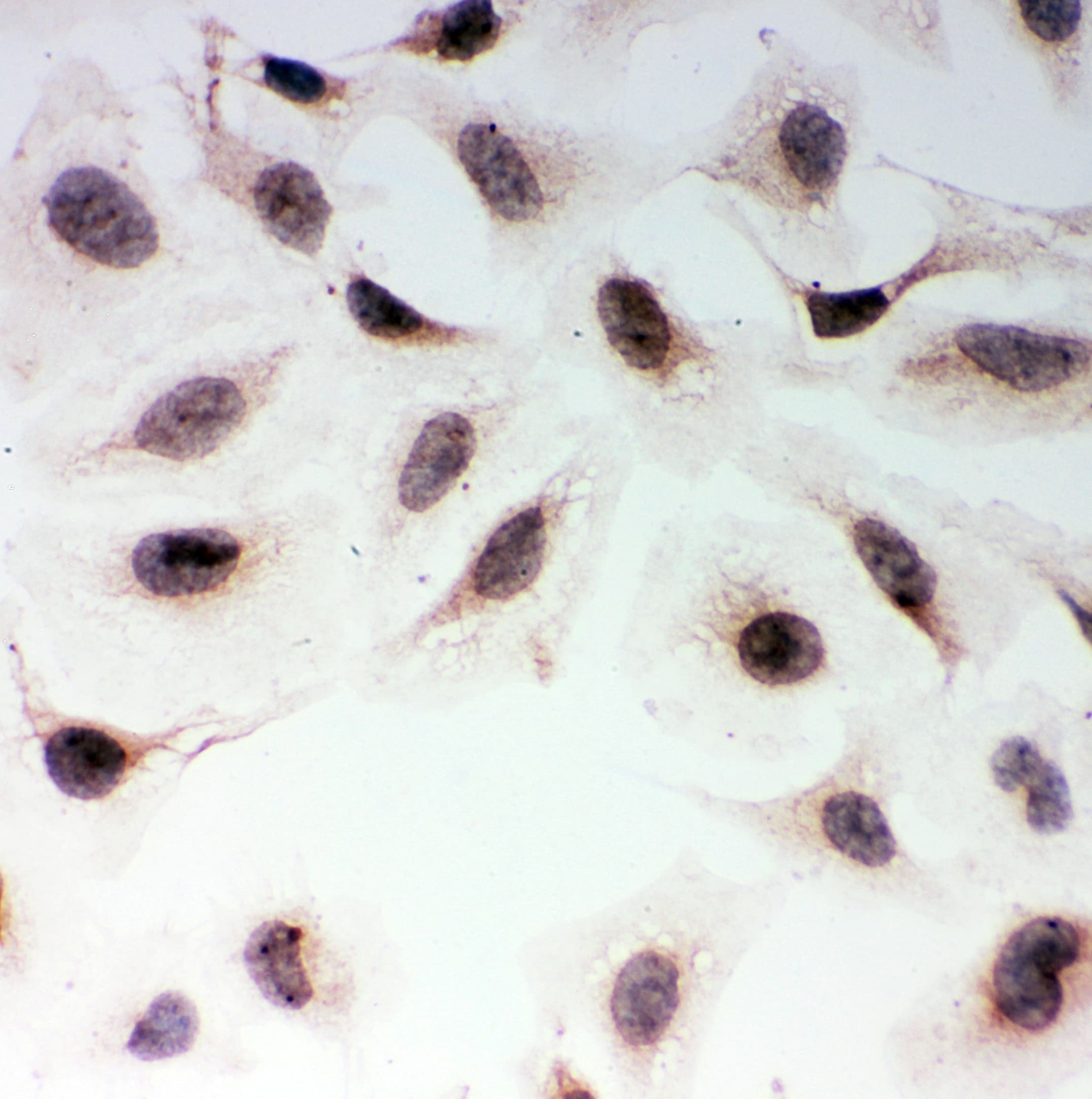 MAD1L1 / MAD1 Antibody (aa362-632)