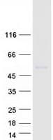 Human KCNJ6 / GIRK2 Protein (Recombinant Myc-DDK (Flag))