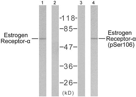 ER Alpha / Estrogen Receptor Antibody (phospho-Ser106)