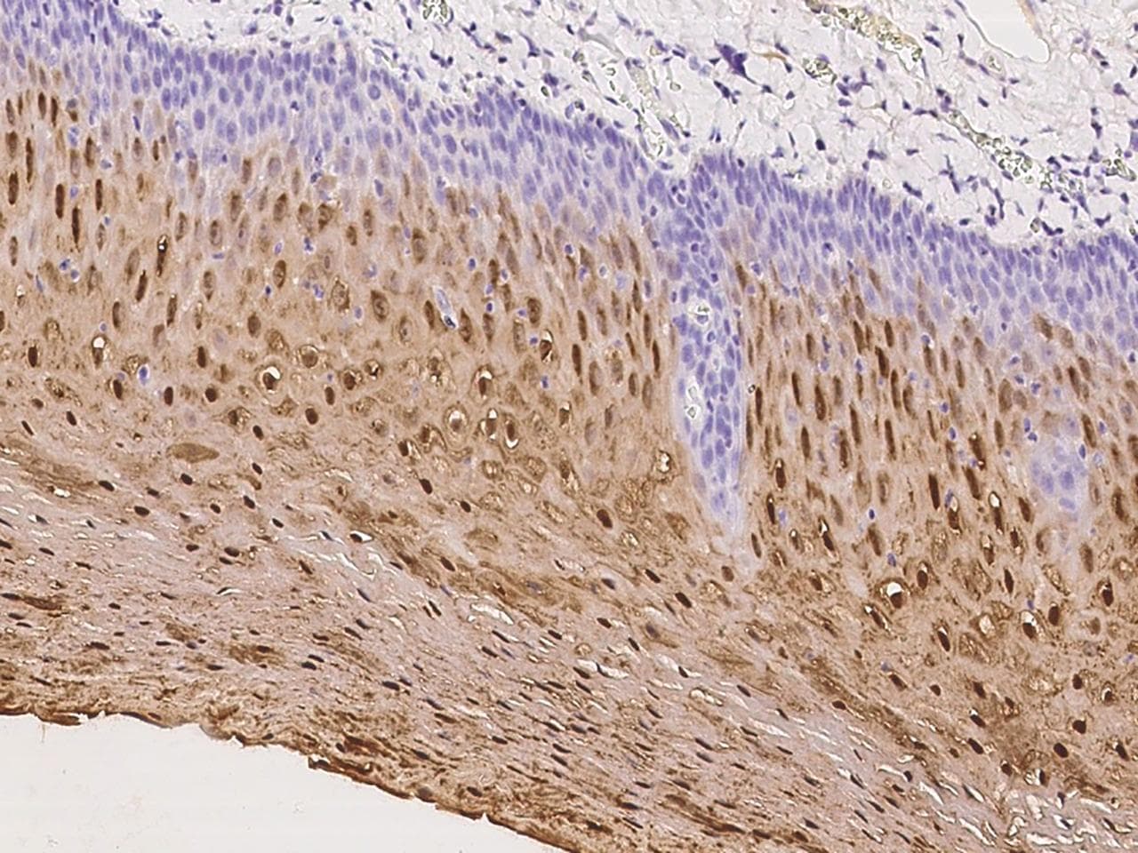 Polyclonal Rabbit anti-Human TGM3 / Transglutaminase 3 Antibody (IHC)