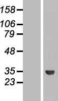 Human ROM1 Protein (Over-Expression Lysate Myc-DDK (Flag))