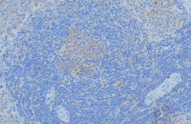 Polyclonal Rabbit anti-Human PGK1 / Phosphoglycerate Kinase Antibody (IHC, WB)