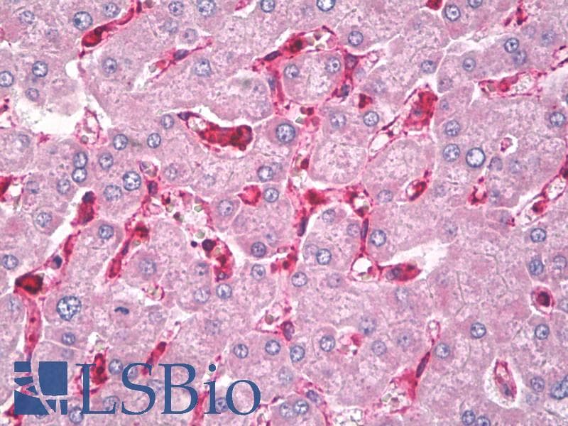 IHC-plus™ Polyclonal Rabbit anti-Human CXCL11 Antibody (IHC, WB)