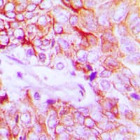 ERBB4 / HER4 Antibody (phospho-Y1284)