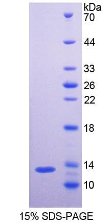 Human ADAMTS7 Protein (Recombinant His)