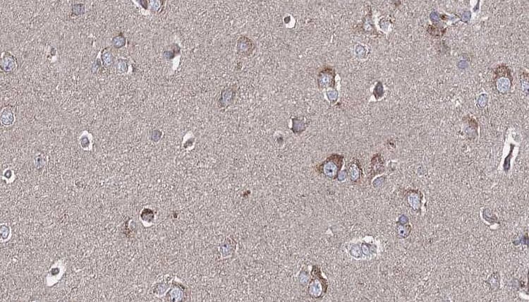 SULT1A1 / Sulfotransferase 1A1 Antibody