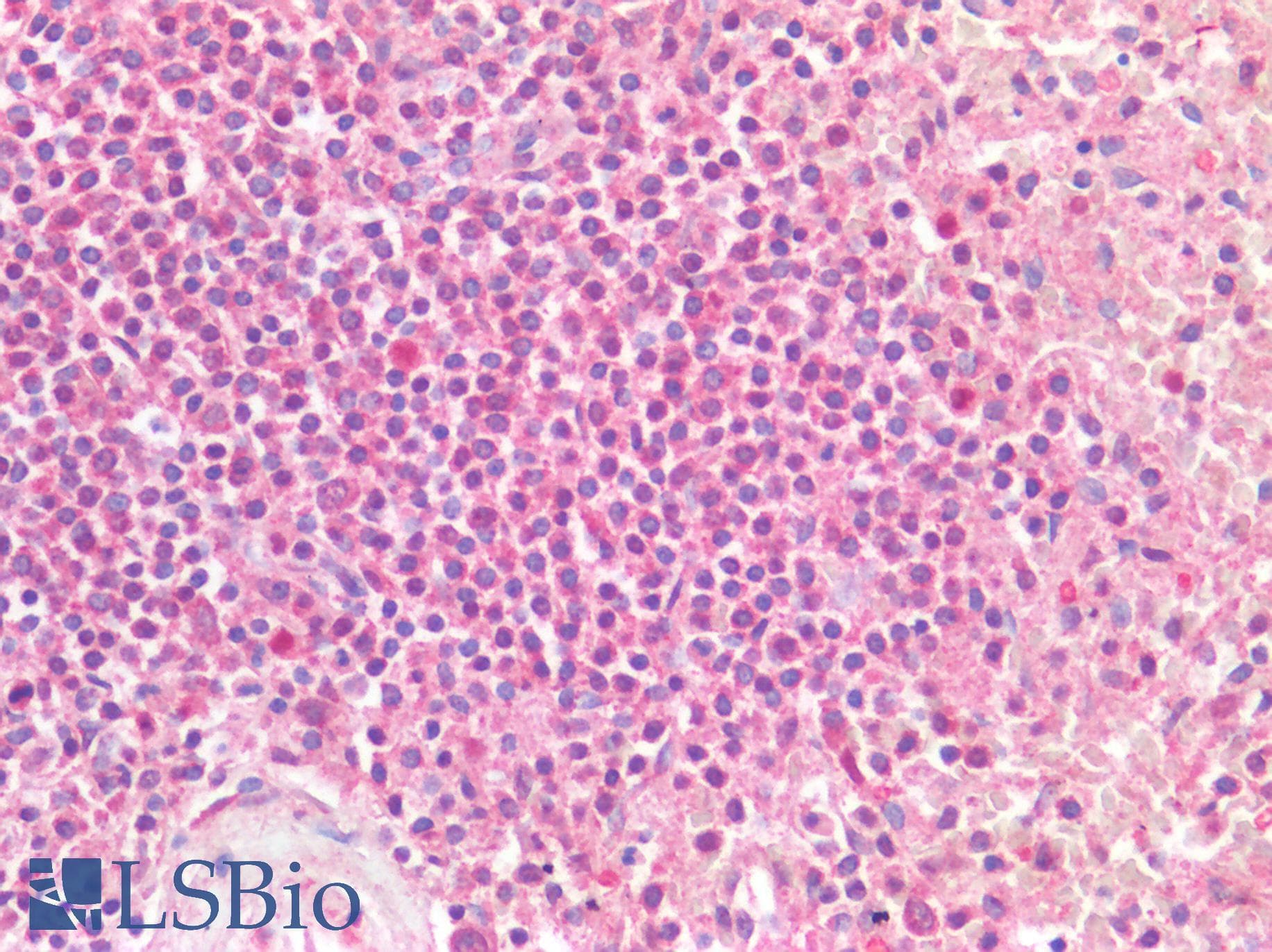 PathPlus™ Polyclonal Rabbit anti-Human CD274 / B7-H1 / PD-L1 Antibody (IHC)