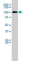 PathPlus™ MVP / VAULT1 Antibody (clone 2H3-1A6)