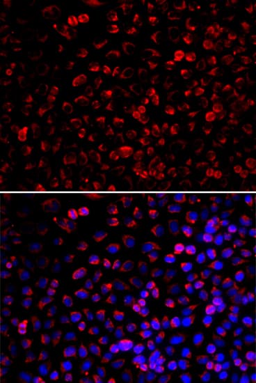 Polyclonal Rabbit anti-Human ENOX2 Antibody (IHC, IF, WB)
