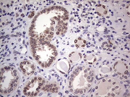HDAC9 Antibody (aa181-460, clone OTI6E2, Carrier-free)
