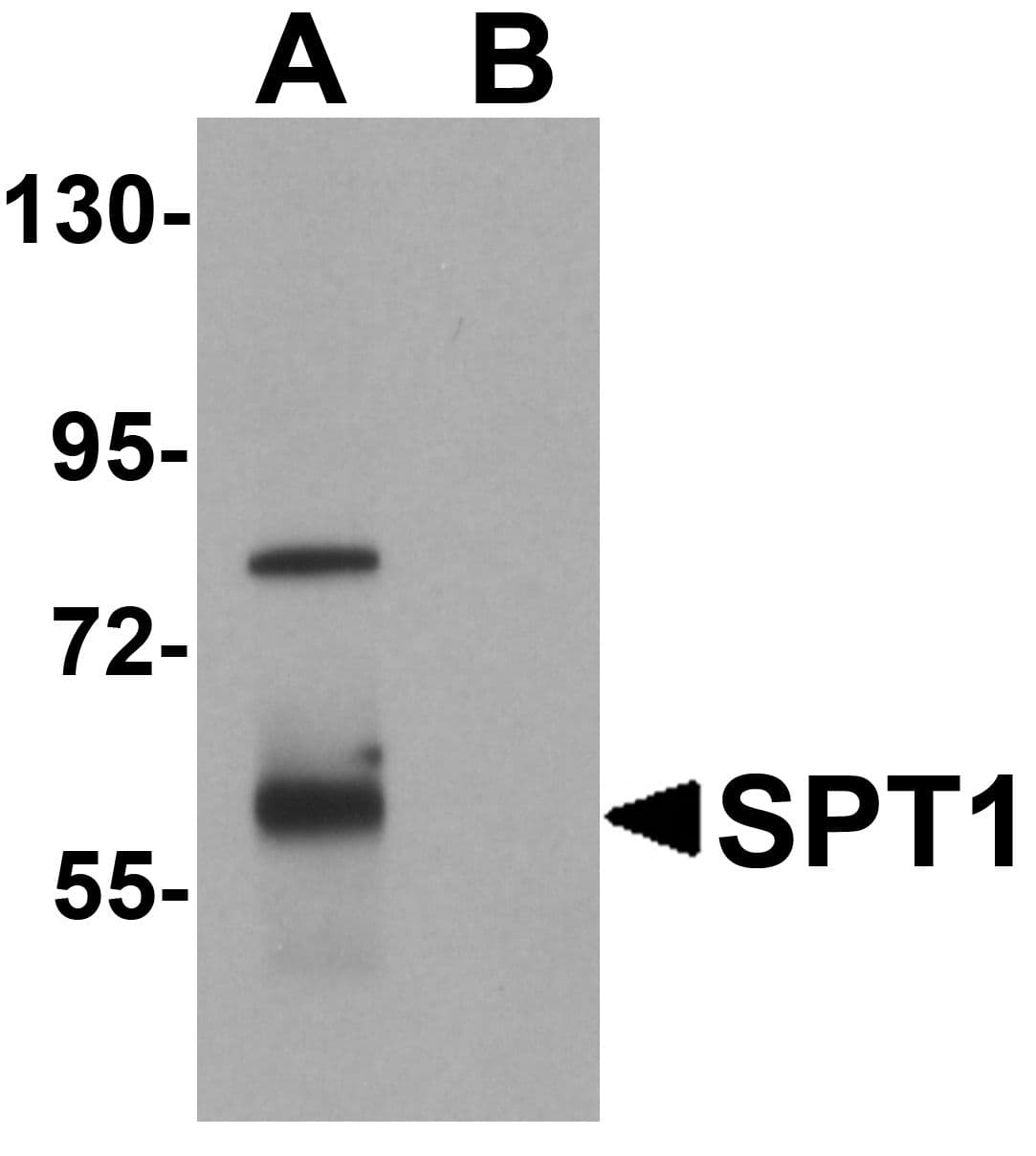 SPTLC1 / HSN1 Antibody