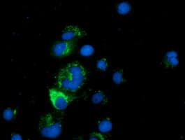 Monoclonal Mouse anti-Human CLPP Antibody (clone OTI1E8, IF, WB)
