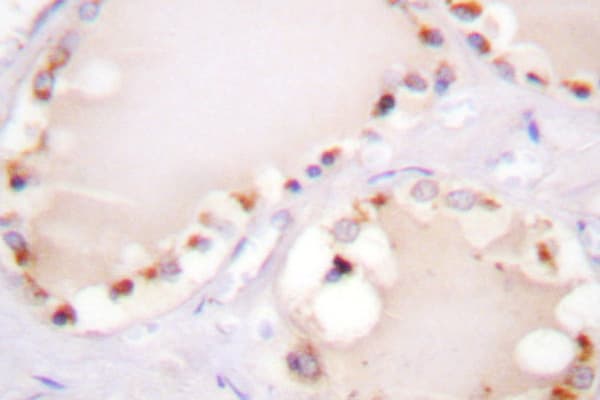 Polyclonal Rabbit anti-Human ETK / BMX Antibody (Leu562, IHC, IF, WB)