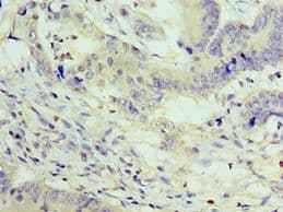 Polyclonal Rabbit anti-Human ZEB2 / SIP-1 Antibody (aa1050-1214, IHC)