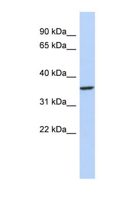 PITX3 Antibody (N-Terminus)