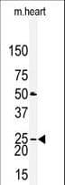 IHC-plus™ CLDN2 / Claudin 2 Antibody (aa135-164)
