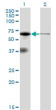 EIF2AK2 / PKR Antibody (clone 1D11)