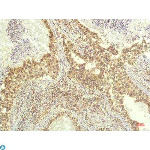 RPS6KB1 / P70S6K / S6K Antibody