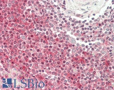 SLAMF1 / SLAM / CD150 Antibody (aa19-236)