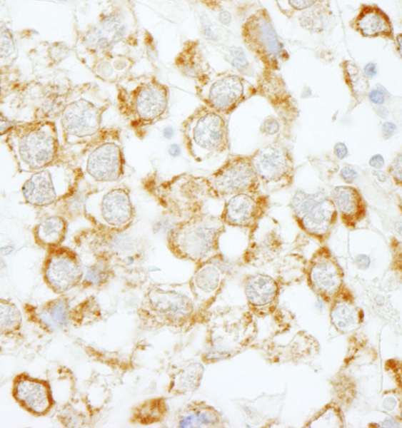 EIF4H Antibody (aa198-248)